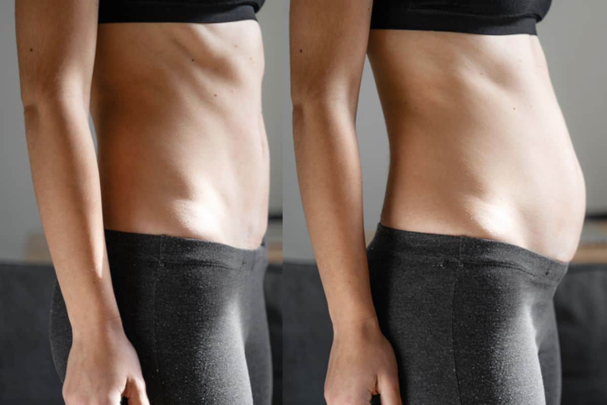 How long does diastasis recti take to improve Liss?