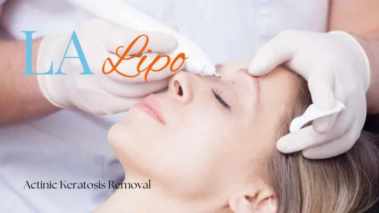 Woman receiving Actinic Keratosis Removal Treatment Liss