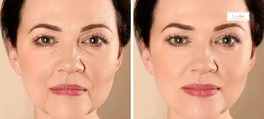 Why Aren’t My Skincare Products Making My Sagging Skin Look Firmer Liss?